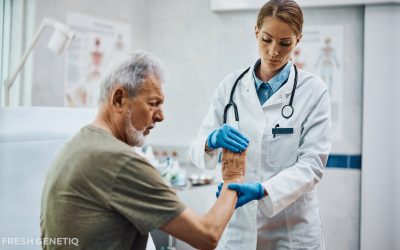 Stem Cell Therapy for Rheumatoid Arthritis