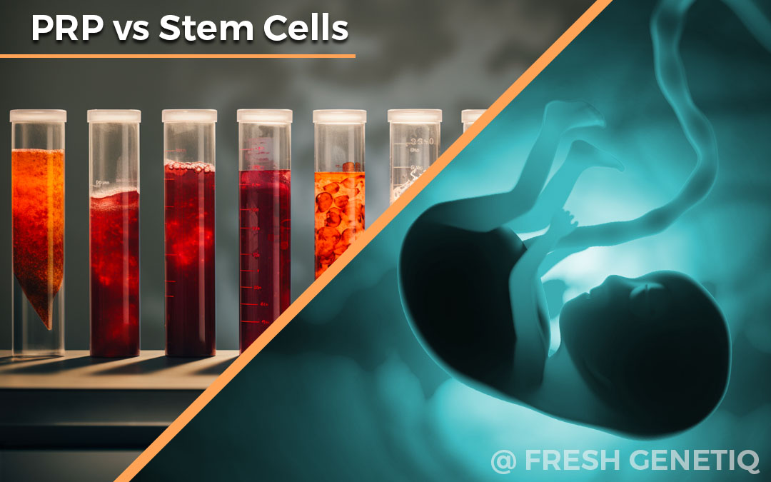 PRP-Difference-Between-Stem-Cells-Pattaya-Bangkok