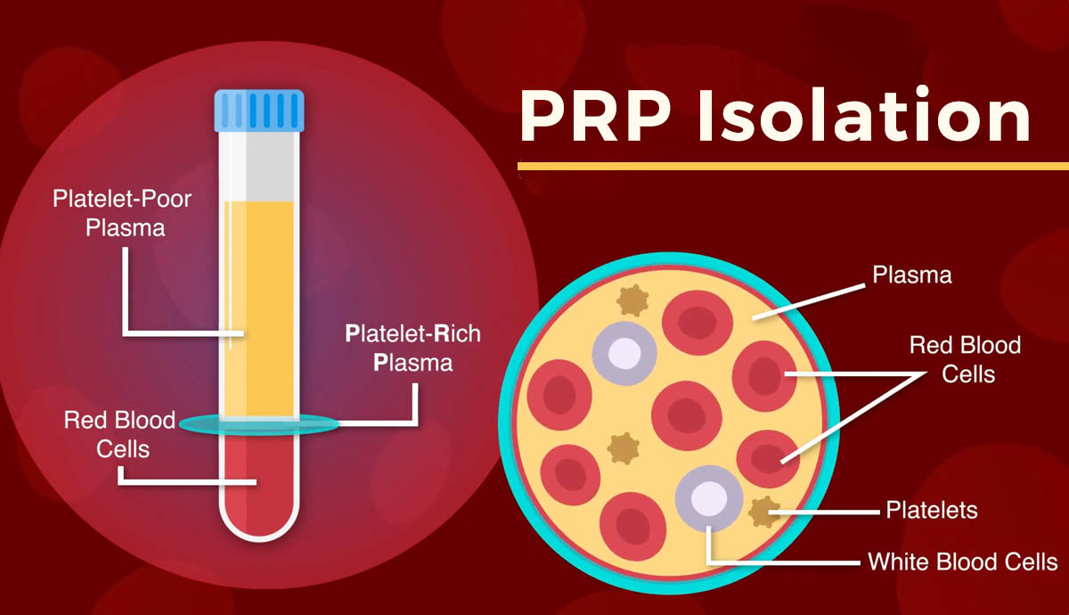 PRP-Injection-Pattaya-Bangkok-Clinic-Thailand PRP-Injection-Pattaya-Bangkok-Clinic-Thailand