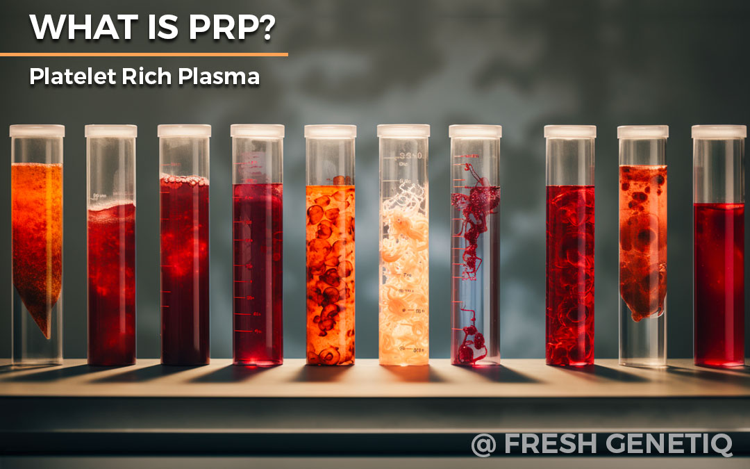 PRP-Pattaya-Bangkok-What-Is-Platelet-Rich-Plasma