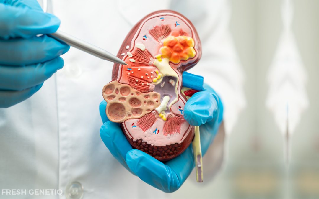 Stem Cell Therapy for Chronic Kidney Disease