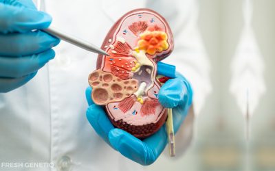 Stem Cell Therapy for Chronic Kidney Disease
