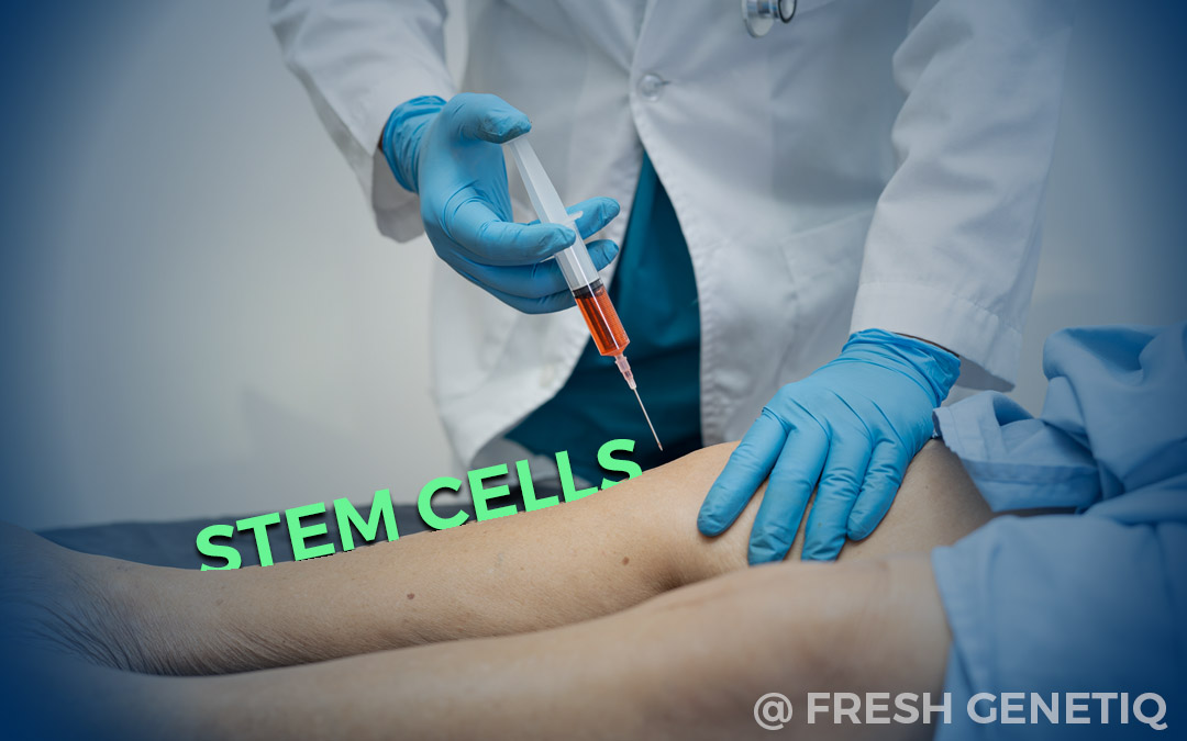Stem-Cell-Pattaya-Bangkok-Thailand-Rheumatoid-Arthritis