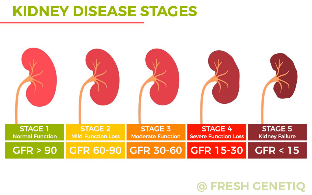 Stem-Cell-Thailand-Kidney-Disease