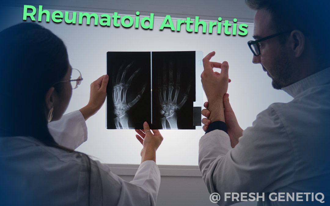 Stem-Cell-Thailand-Rheumatoid-Arthritis